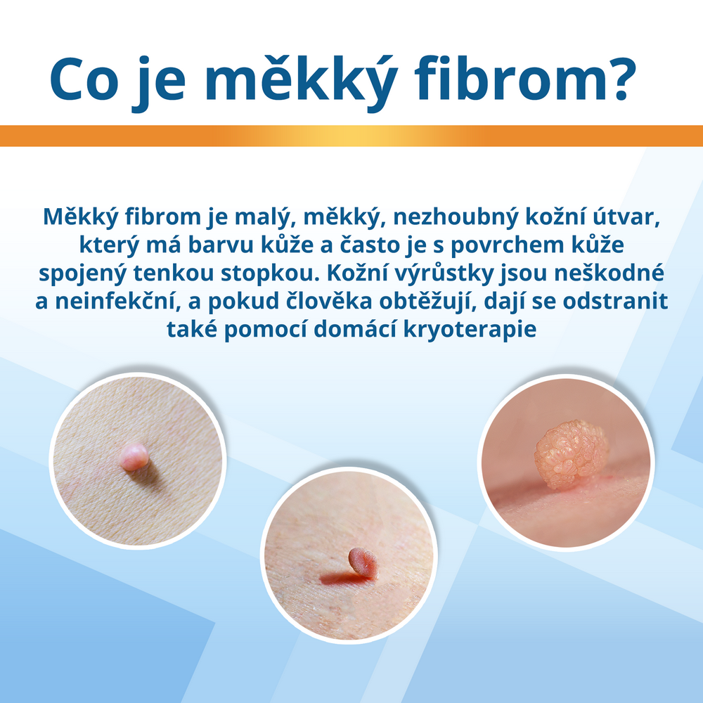 ENDWARTS Extra kryoterapie fibromů 14.3g - Lékárna.cz