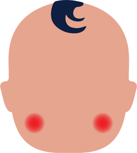 Obrázek NUROFEN Pro děti jahoda suspenze 20 mg/ml 100 ml II (13)